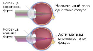 Психосоматика глаз как твои страхи влияют на зрение