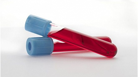 7 советов как правильно сдавать анализ крови
