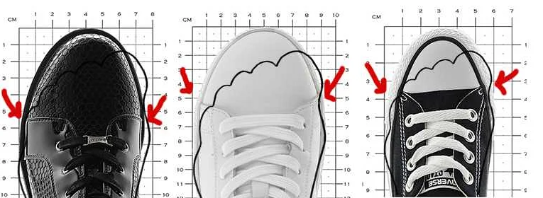Правильная обувь как избежать «косточки» и других проблем ног